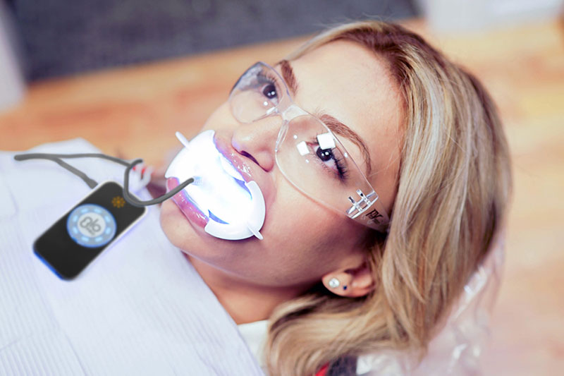 Teeth Whitening in Parkville